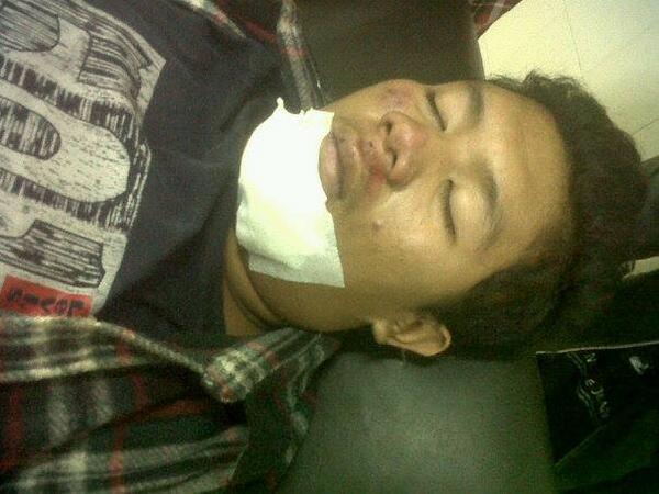 VIUL_HANGOVER13's tweet photo. thx demi uties uyee, dijalan mengalami kecelakaan. ndang waras son, jamming lagi #uyyeee http://t.co/tZLMoMWW0X