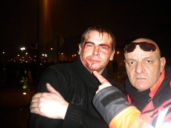sans_masques's tweet photo. #JourDeColere RUES BLOQUÉES, PRIS EN TENAILLE PAR LES CRS POUR NOUS POUSSER A L'AFFRONTEMENT, CALCULE D'AVANCE ! http://t.co/igyizaquel