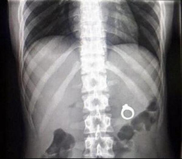 proposingguy's tweet photo. “@GroovyGroomsmen: trying to surprise your girlfriend with a ring in her milk shake http://t.co/jRk6PqJALJ” HAHA I'll give that one a miss!!