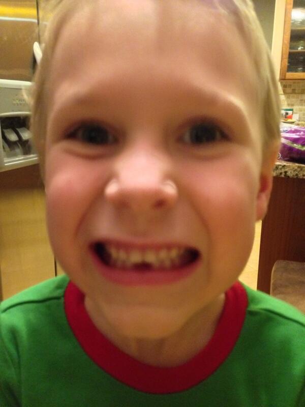 RVNGERK's tweet image. He lost TWO bottom teeth within a few hours! #firstteeth