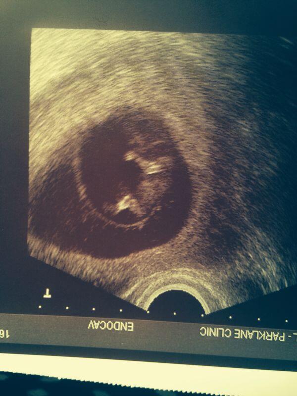 Lach_Niven's tweet photo. This little one is only gonna have the best uncle ever! Too stoked for words http://t.co/oGAN3cXpmT