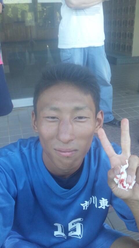 NotBlackman's tweet photo. @1_riii3 打撲じゃない？これ鼻折れてる写真 http://t.co/1wL4184PTa