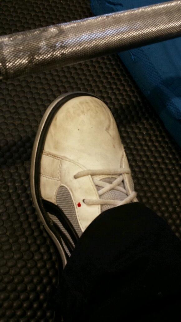 iChrisShaw's tweet image. You know you are keeping that bar close when the blood is dripping down onto your shoe #olympiclifting #snatchpulls