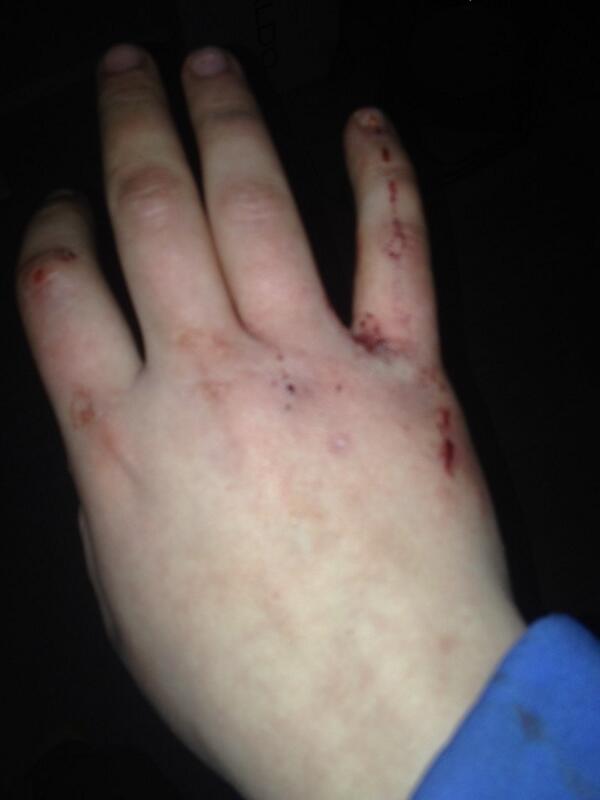 raefabish10's tweet photo. @LJohnson00 thanks for teaching me how to punch http://t.co/p7jMiHbRUP