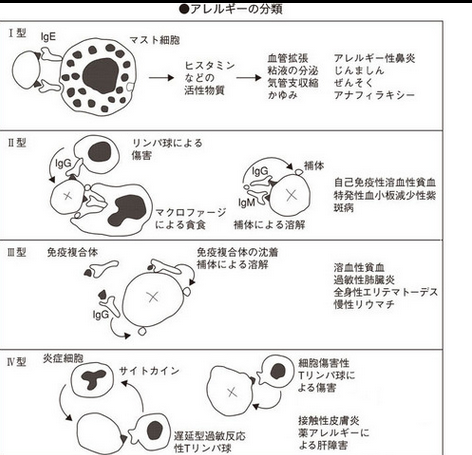 ゴロ 解剖生理イラスト בטוויטר アレルギーの分類 Http T Co Jndxhoi6h2