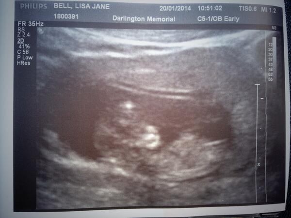 LisaJBell23's tweet photo. Our little one #babyT #excitingtimes ❤😍😁🚼🍼❤@spiklad http://t.co/qgIljg2KnX