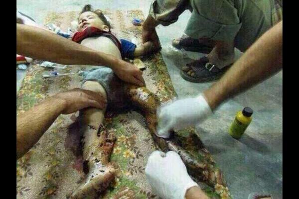 Nerde insanlık,nerde uygarlık,nerde dünya nerde,sessiz kaldı zulme, #SyriaWarCrimes