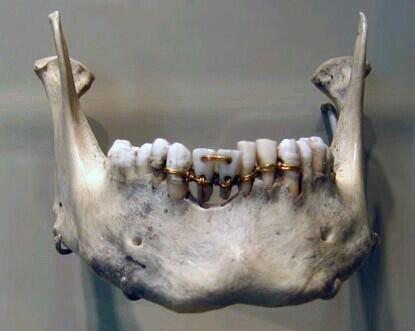 ThatsHistory's tweet photo. Dental work on a Mummy from ancient Egypt that archaeologists have dated to 2000 BC http://t.co/h34FmF5zt4