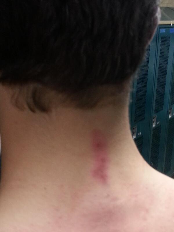 Kingwilderr's tweet image. Football probs #Bearcomplex