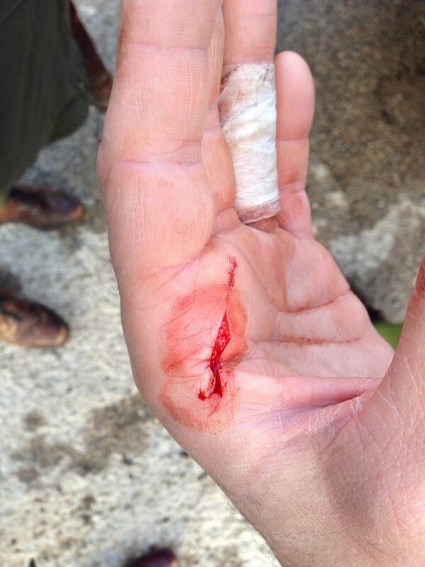 Mmmmmm, unsurprisingly, this is what happens when you try to open a bottle of champagne with a sword.#muppet