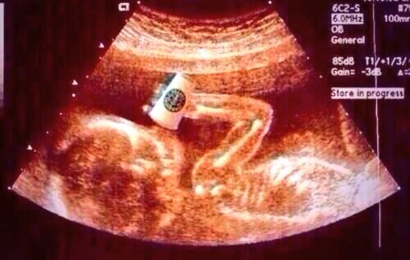 wordstionary's tweet photo. congratulations it’s a white girl! http://t.co/D56ObFDLwg