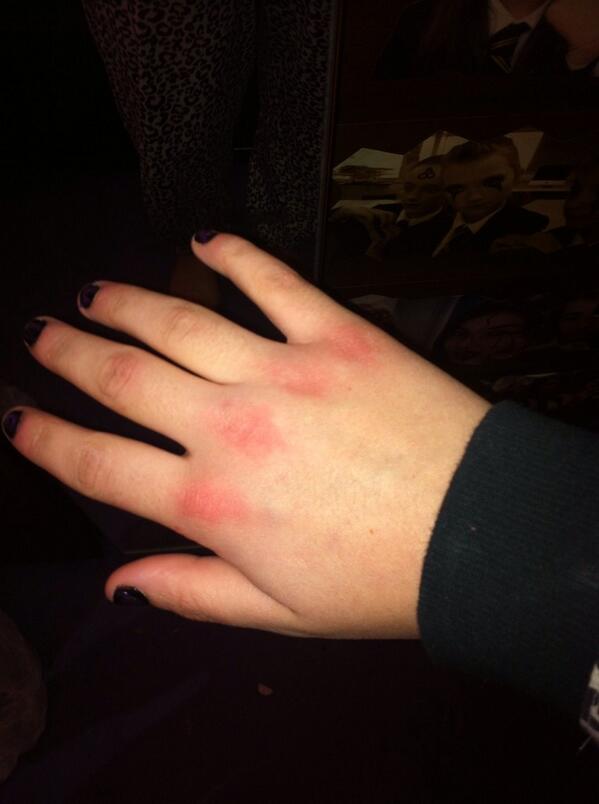 gee_bvb's tweet image. Just punched my mirror lol hand feels broke but my mirrors fine :)