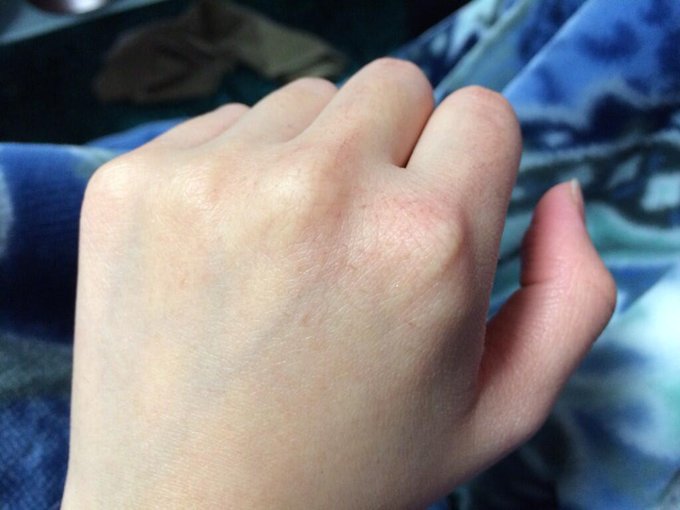 おててがガサガサすぎて 切れているではないかっ((((；ﾟДﾟ))))))) http://t.co/gZ7Xbg0dLO