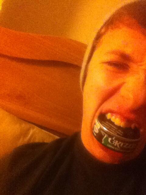 SickNastySkyler's tweet image. @MackAttackNoes #fulltin my gums are killin me