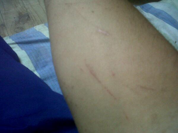 GOATCHRIST2000's tweet image. Sweet pain