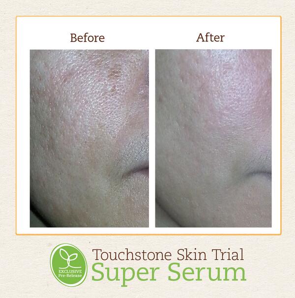 After just 3 days with the #SuperSerum, Jonalyn could see and feel the difference in her skin.