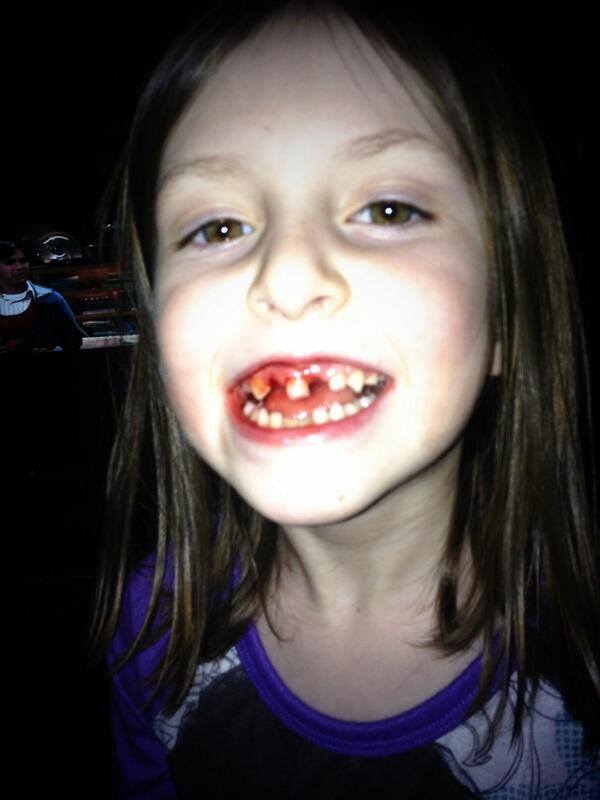 noelleyjane's tweet image. Deer hunting? #bloody #toothpuller