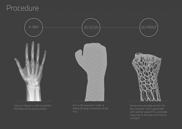 3D printing has been practically implemented fairly successfully - here is an illustration of the 3-step process.