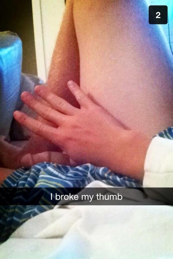 WackySnapChat's tweet photo. I broke my thumb http://t.co/Fuo5tc7lvz