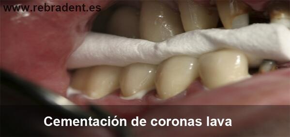 RebradentLab tweet picture