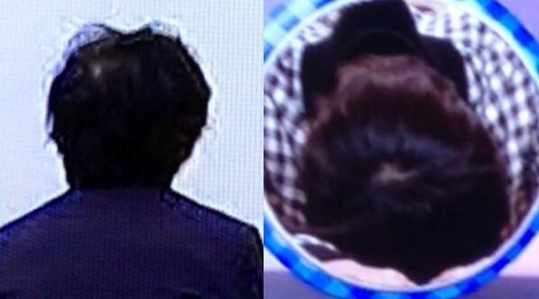 うさころり در توییتر くらりょのつむじを並べてみた 亮ちゃんのつむじ 左 忠義くんのつむじ 右 Http T Co 6xppks7k1x