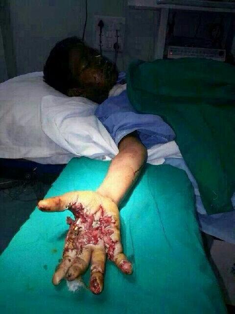 انفجر الجوال هو يكلم ﷲ͜ يشفيه يارب