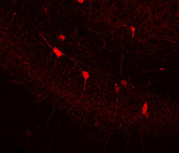 katiesci's tweet image. Took this lovely little picture today. #science #interneurons #prettylittleprocesses #gradschool