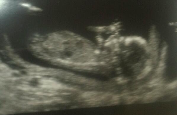 nicolathomson's tweet photo. baby carswell due 29th july :D http://t.co/MmwuXTFlIm
