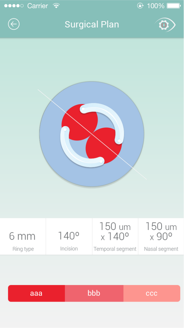 KeratoconusFix's tweet photo. easy fix http://t.co/EKSd1F9b3L