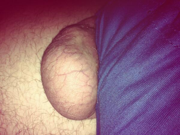 FatBaldSlut's tweet photo. Random bollock popped out #popout #testical #MindOfItsOwn http://t.co/H8H0hO3Brc