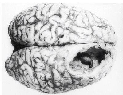 Twitter पर 鋒山 芽殖孤虫症 寄生虫が無性生殖を繰り返し身体中に寄生して行く 末期には身体の至る部分に寄生虫が詰まった水泡ができて死ぬ 何の幼虫なのかも全くわからないため治療法もない T Co Jeqstxymbs