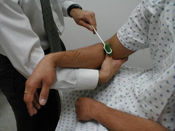 магнито волновая терапия. врожденный анкилоз локтевого сустава. электрофорез на локтевой сустав. локтевой сустав кт норма. врач суставы.