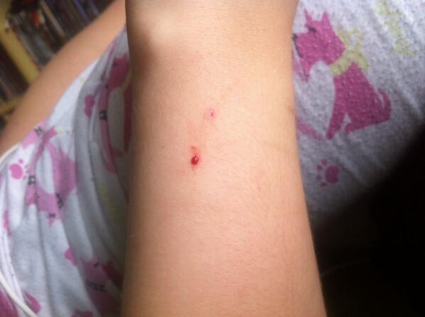 babiclone's tweet photo. TO TENDO UMA HEMORRAGIA SE EU SUMIR LIGUEM PRO SAMU http://t.co/ol7wuQRSd6