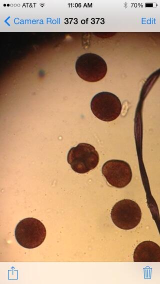 tyland24's tweet image. Growing a sea urchin #developmentalbio @_zack_brown