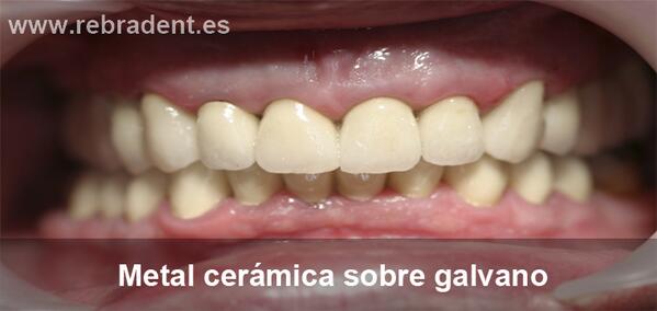 RebradentLab tweet picture