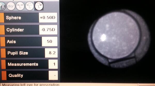 EyeHelpUC's tweet image. #IntraocularBifocalLens taken with the Izon equipment.