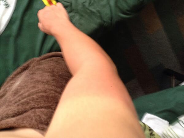 JonoVerrall98's tweet photo. Got frazzled yesterday.. http://t.co/504caL61do