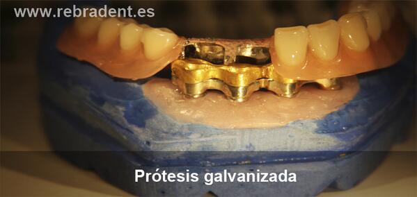 RebradentLab tweet picture