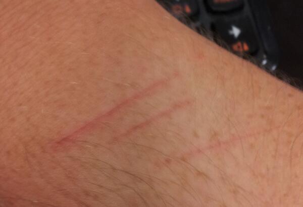 cavanaghtomas's tweet photo. Las #garras de un gato de 4 meses son la muerte misma....#ouch http://t.co/7ez3GOxz1f