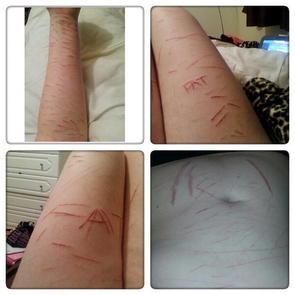 perfbodyplease's tweet image. Current state of my body