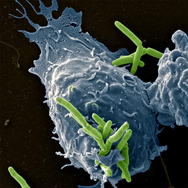 TheScientistLLC's tweet photo. Image of the Day: A mouse macrophage rapidly engulfs Mycobacterium bovis. #IOD http://t.co/Js8DuXEu59 http://t.co/2Ql5Vimj0C