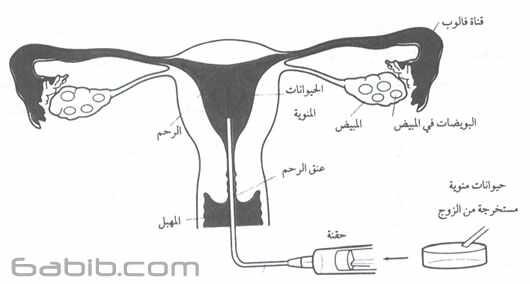 17Kad4teene's tweet photo. هذا معلومات http://t.co/zbCtsjfvmB