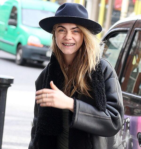 MelCharlieJoe's tweet image. What is with this trend of celebs flaunting their Grillz? Do they not see that they look like they've got Meth Mouth?