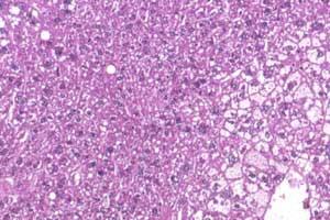 Cytoplasm_rulez's tweet photo. #WCW my baby boo #cytoPLAYA #datssomecytoplasmyo #bae http://t.co/MYohl7p5xv