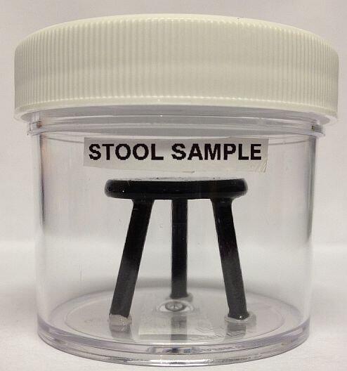 MandyBirdieBird's tweet image. Hint to my new blog post:
#StoolSample #MyIBDLife #poop #crohns #UC