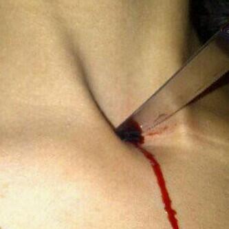 khaled177517964's tweet photo. ليت الجروح قصاص واخذ بثاري
لجرحك جرحن مايداويه دكتور http://t.co/QVfy0c4I3h”