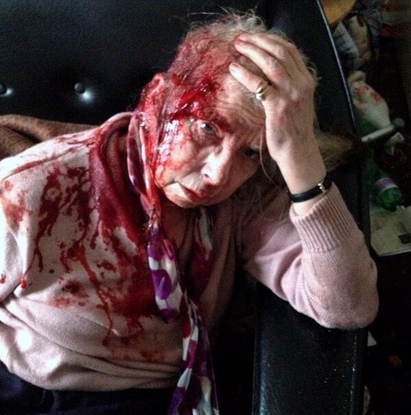 AirForce_Carl's tweet photo. ⚠️ FIND THE THUG who did this to Jean Taylor, 76 from Bristol after ransacking her home and taking just £100! http://t.co/HqfTko3PjX
