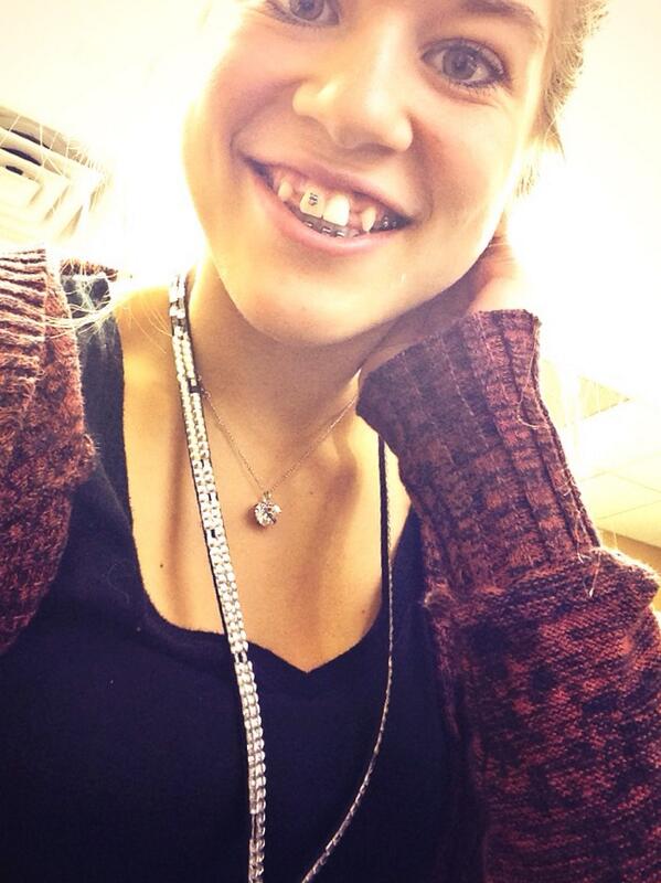 JaclinStonacek's tweet image. #Noteeth