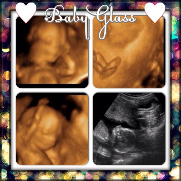 tglass08's tweet photo. Can't wait to see what our sweet baby is Saturday! @CGlass06 http://t.co/KqAoTuZj14