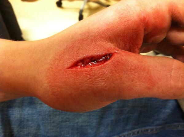 draid95's tweet photo. We were always taught cut away from yourself but I'm hard headed hahahahaha ! http://t.co/fWPYZZGmPZ